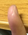 fingerscar.jpg