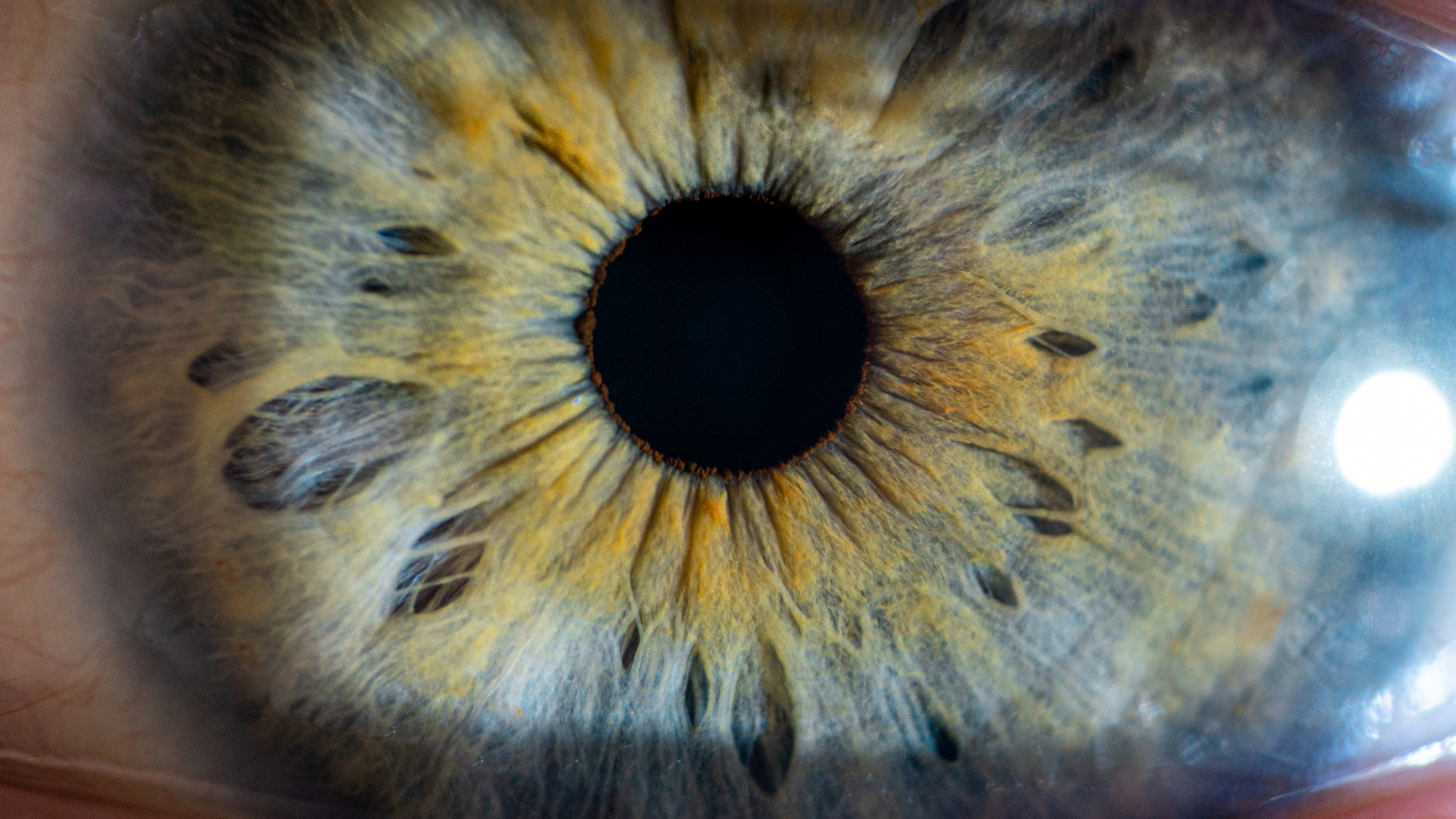 www.allaboutvision.com