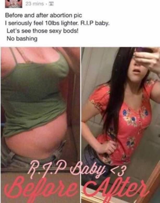 Before_And_After367.jpg