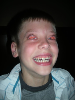 jake+flip+eyes.jpg