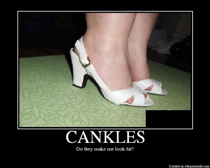 cankles.jpg