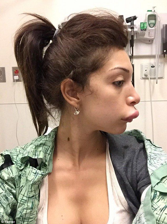 farrah-abraham-lips-1.jpg