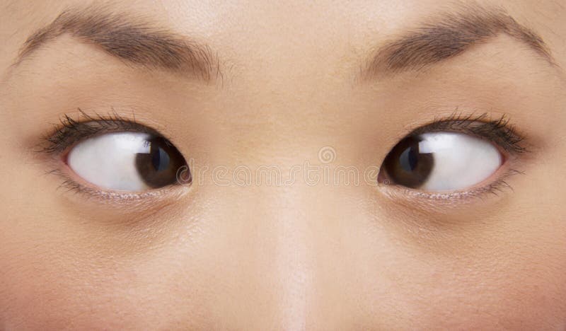 cross-eyes-young-woman-extreme-closeup-eyed-31834683.jpg