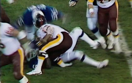 Joe-Theismann-broken-leg.jpg