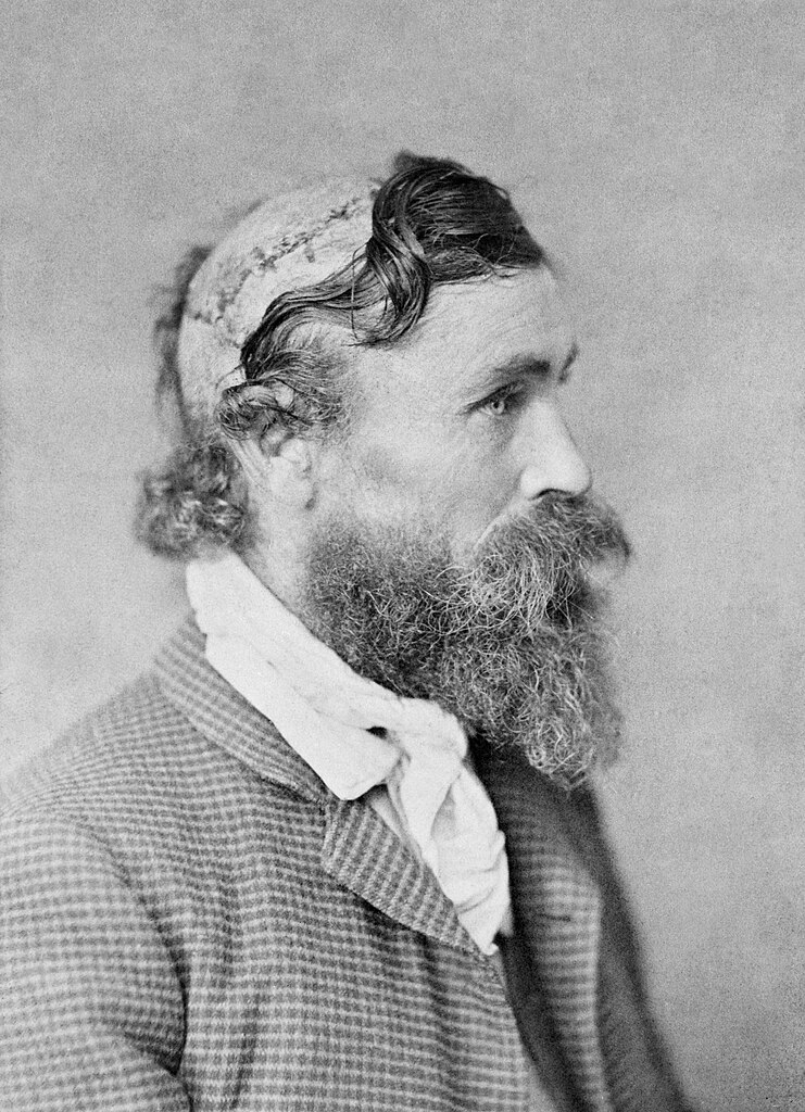 741px-Robert_McGee,_scalped_as_a_child_by_Sioux_Chief_Little_Turtle_in_1864-2.jpg