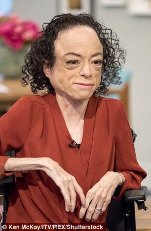 4348661300000578-4794052-Silent_Witness_actress_Liz_Carr_pictured_was_stabbed_in_the_head-m-7_1502870138821.jpg