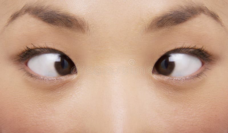 cross-eyes-young-woman-extreme-closeup-eyed-31834683.jpg