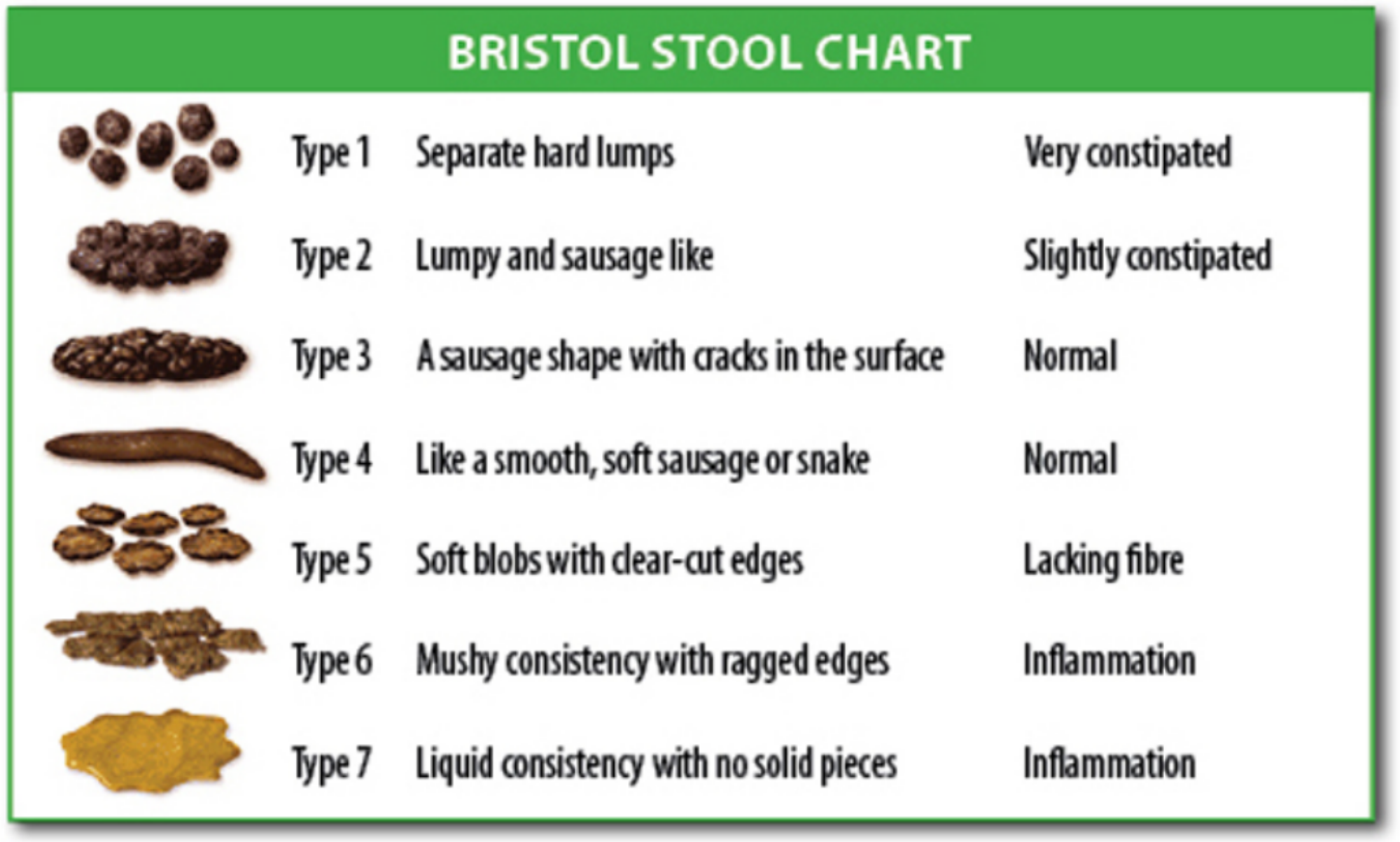 2000px-Bristol_stool_chart.svg.png