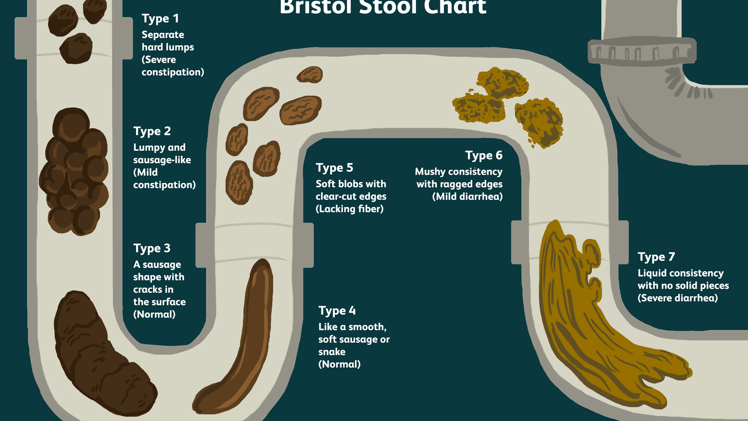 bristol-stool-chart-4174964-v3-5bda0c2cc9e77c0051ed7541.png